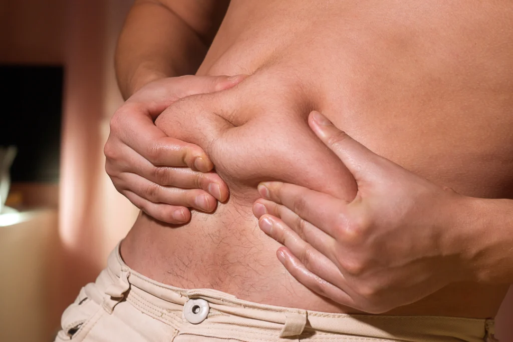 A close-up of a hand pinching abdominal fat, showcasing the need for CoolSculpting treatment.