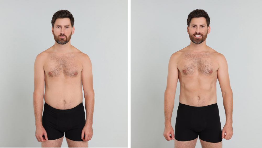 Before and after body transformation through medspa treatment.