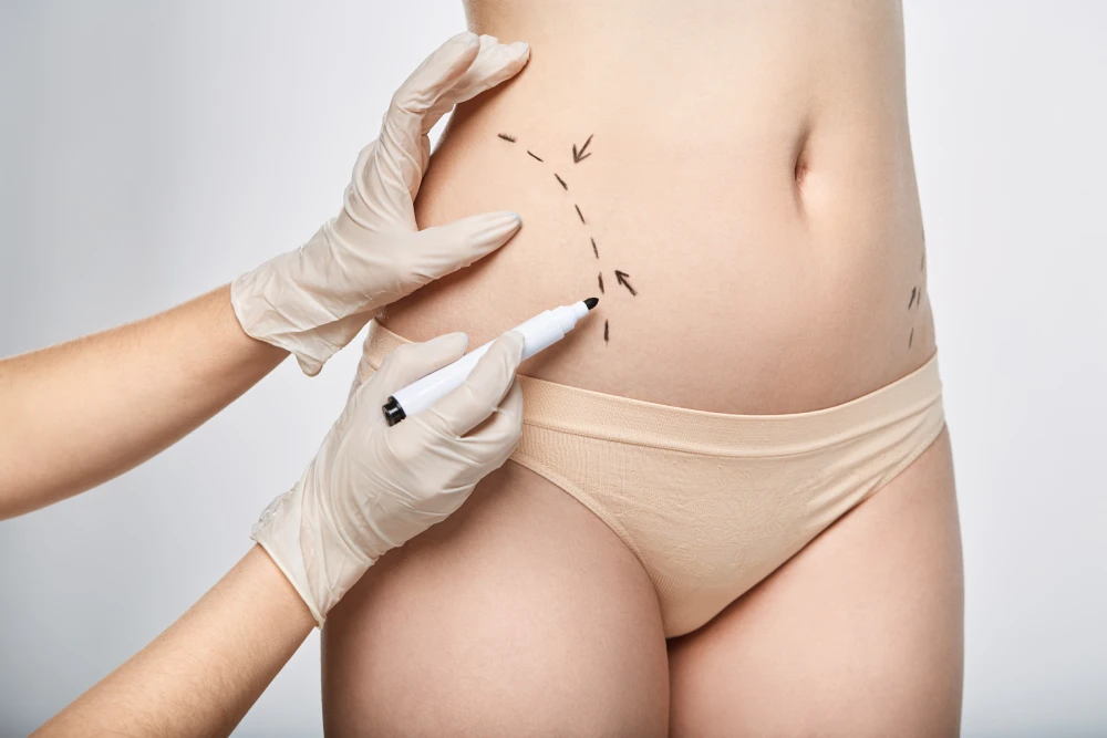 Hands drawing contour lines on abdomen