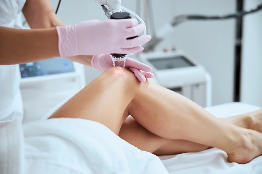 Laser spider veins treatment on a patient's leg.