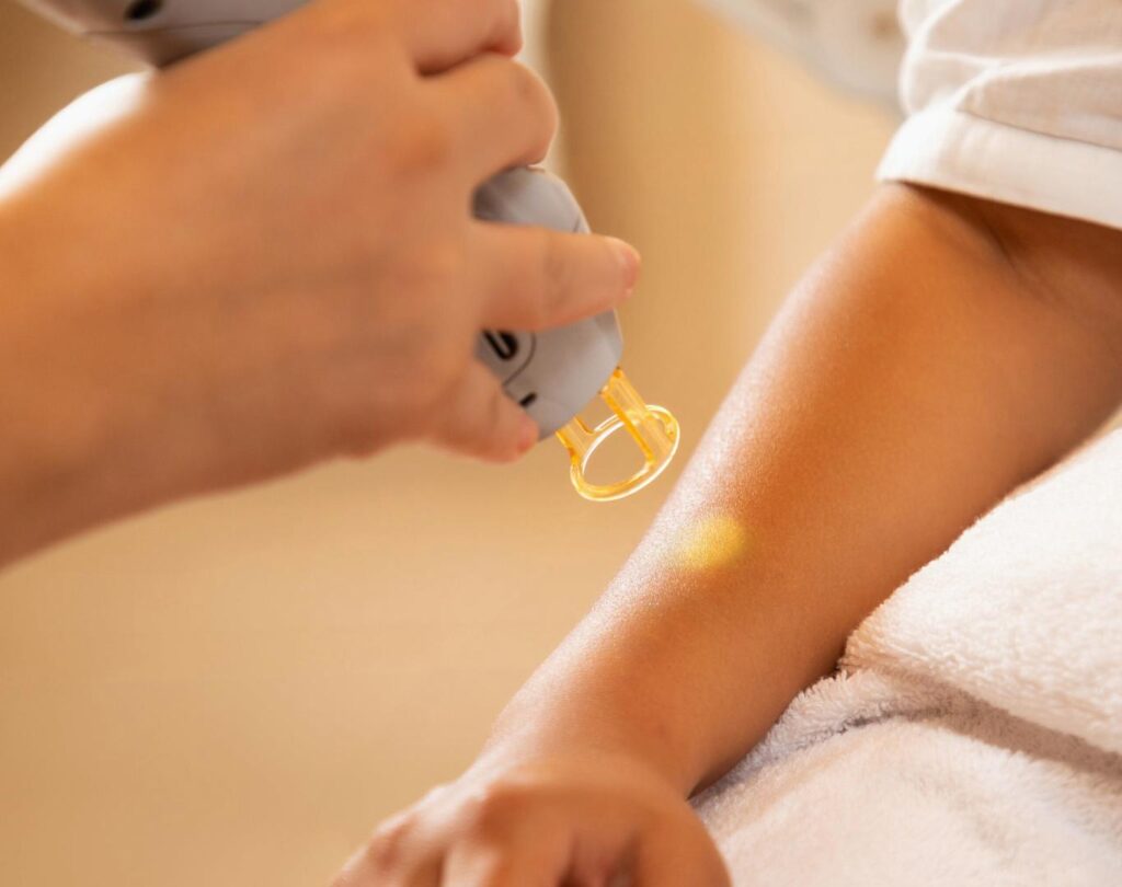 Comfortable treatment experience at a laser hair removal clinic near me in Londonderry, NH