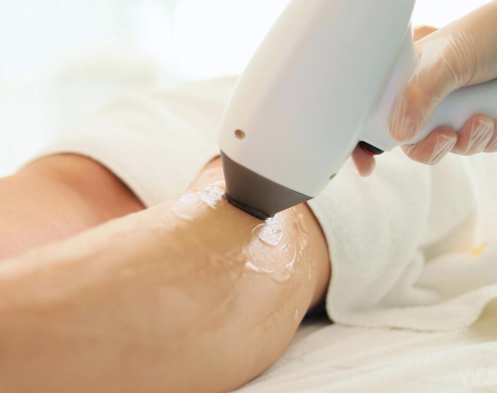 Personalized session at a laser hair removal clinic near me in Derry, NH