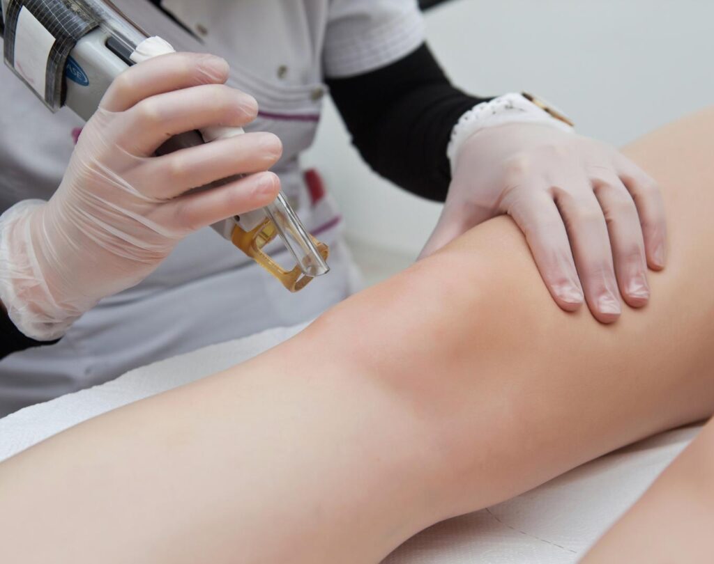 Personalized treatment at a laser hair removal clinic near me in Atkinson, NH