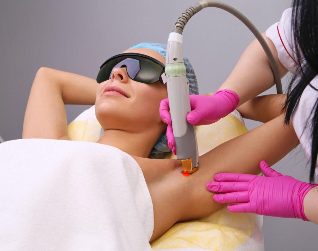Professional laser hair removal in Derry, NH delivering lasting results