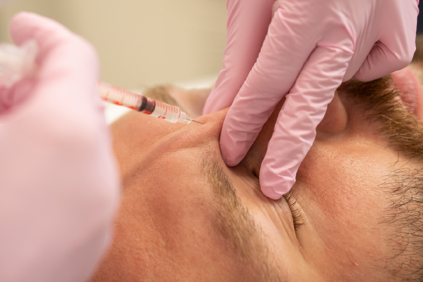 Close-up of a clinician wearing pink gloves injecting a man’s forehead near the brow area with a syringe.