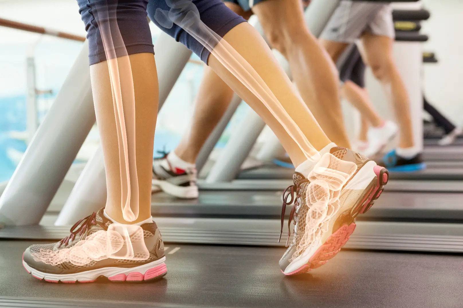 Close-up of legs walking on treadmill with bone structure overlay