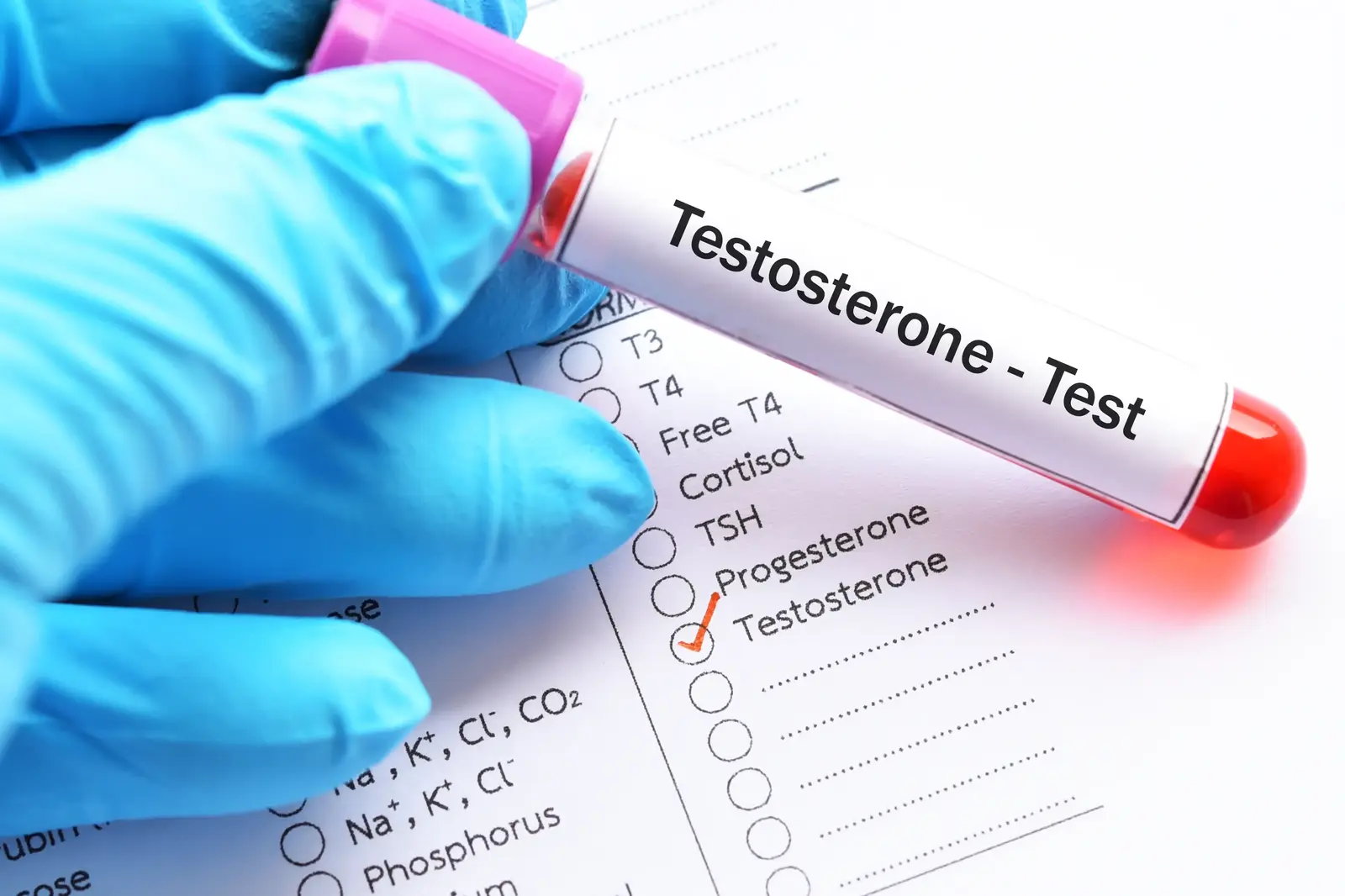 Gloved hand holding a blood sample tube labeled testosterone test above a laboratory request form.