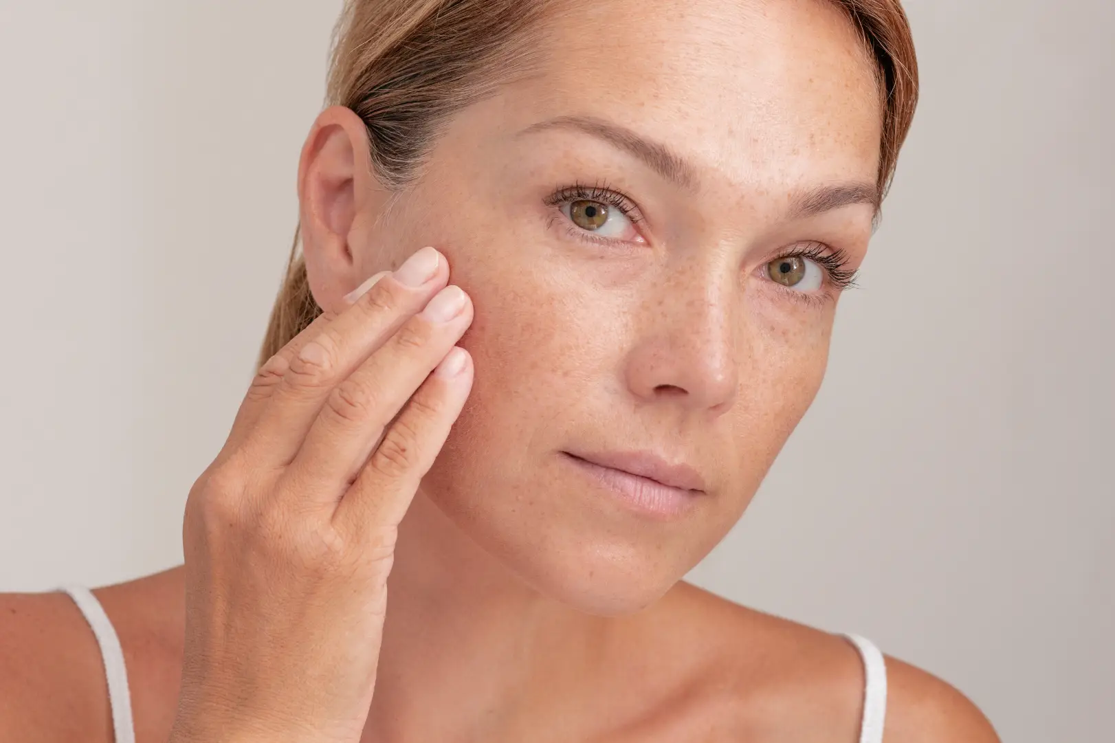 Close-up of a woman touching her cheek, with freckles and natural skin texture visible across her face.